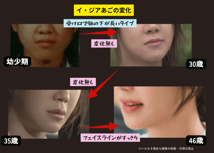 韓国女優イ・ジアの顎の変化について時系列検証画像
以下4枚の画像

幼少期（左上画像）
30歳（右上画像）
35歳（左下画像）
46歳（右下画像）
46歳現在の画像は、ほおとあごがシャープになりフェイスラインがすっきりした印象。